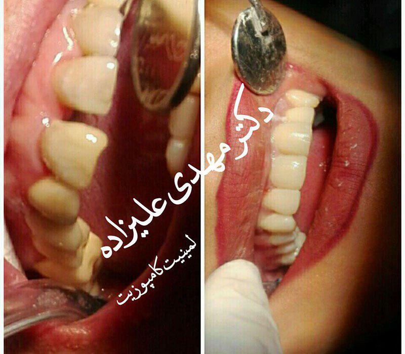 دکتر مهدی علیزاده جراح دندانپزشک ایمپلنت ارتودنسی لمینت در مشهد