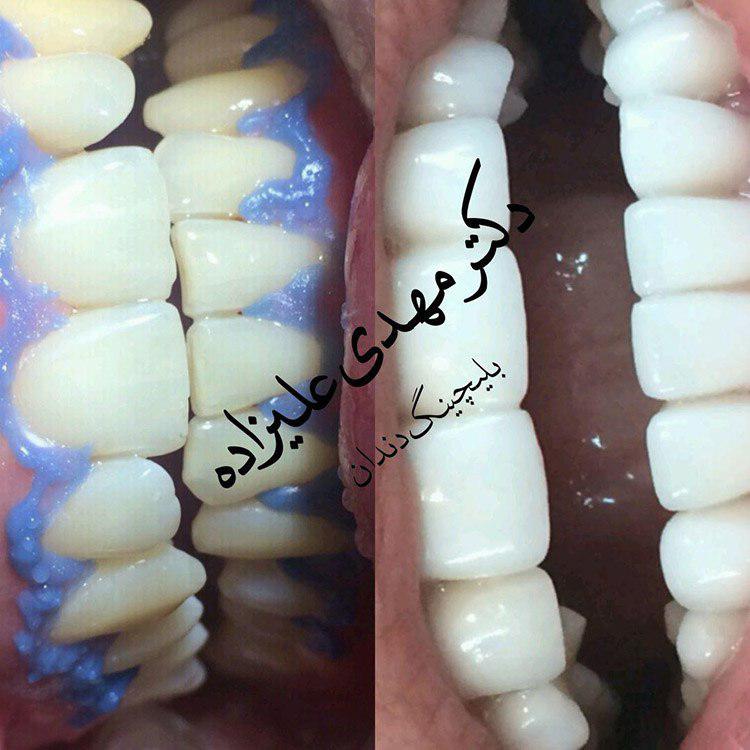 دکتر مهدی علیزاده جراح دندانپزشک ایمپلنت ارتودنسی لمینت در مشهد