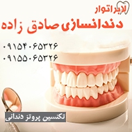 ساخت پروتز دندان ثابت و متحرک در مشهد