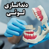 دندانسازی لوئی در مشهد