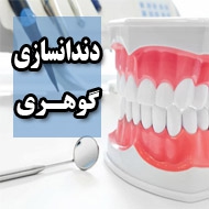 دندانسازی گوهری در مشهد