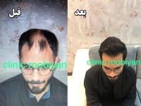 کلینیک تخصصی پوست و مو و لیزر روبیان در مشهد