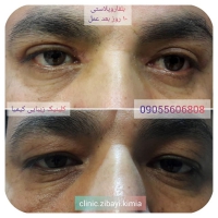 جراحی های زیبایی دکتر مرتضی پیوندی در مشهد