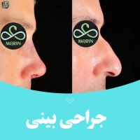 کلینیک زیبایی مارین در تهران