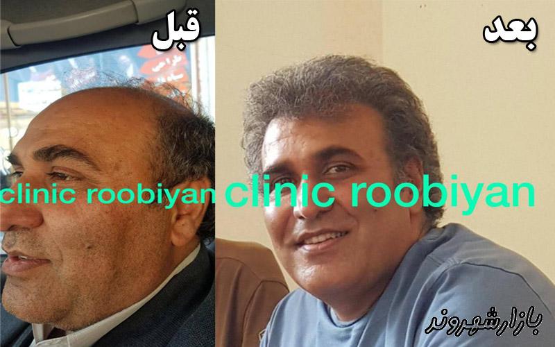 کلینیک تخصصی پوست و مو و لیزر روبیان در مشهد