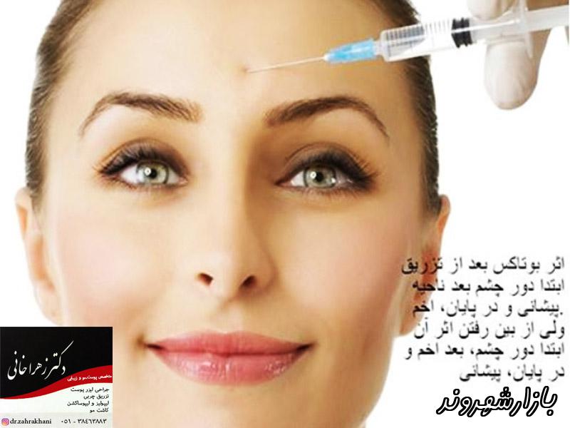 دکتر زهرا خانی متخصص پوست مو زیبایی در مشهد